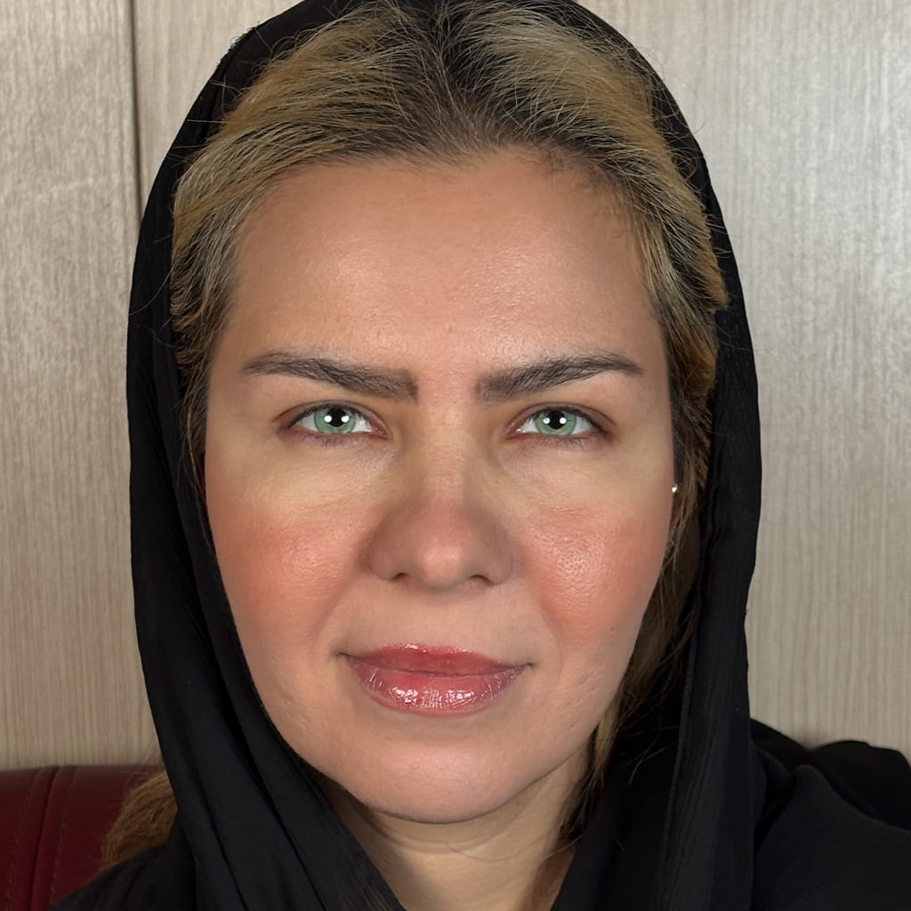 بعد عملية تصبغ القرنية — نتيجة لون أخضر للعين، إيران