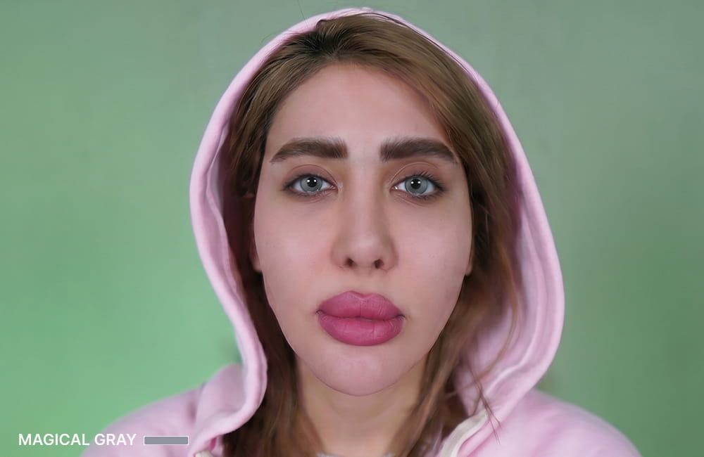 مريضة إيرانية بعيون رمادية سحرية بعد تغيير لون العيون الدائم بزراعة الصباغ القرنية في مركز عيون كروماتيك الطبي