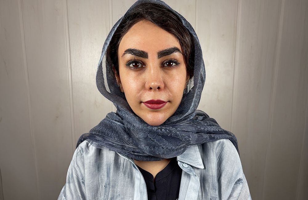 عين المريضة قبل تغيير لونها بتقنية الكيراتوبيغمنتيشن في Chromatic Eyes