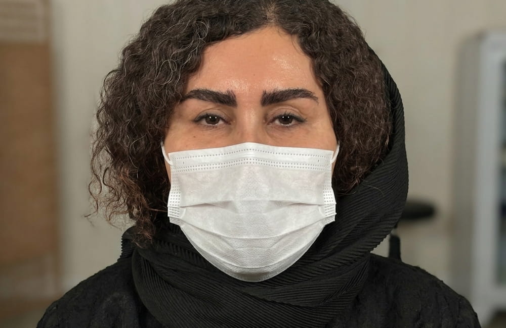 مريضة إيرانية بعيون بنية طبيعية قبل تغيير لون العيون بزراعة الصباغ القرنية في مركز عيون كروماتيك الطبي