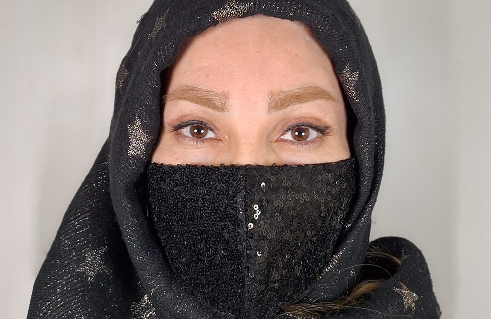 مريضة إيرانية بعيون بنية طبيعية قبل تغيير لون العيون بزراعة الصباغ القرنية في مركز عيون كروماتيك الطبي