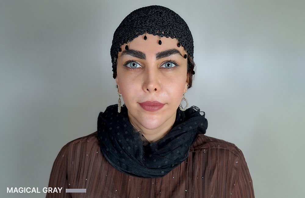 نتيجة اللون الرمادي الساحر بعد إجراء الكيراتوبيغمنتيشن في Chromatic Eyes