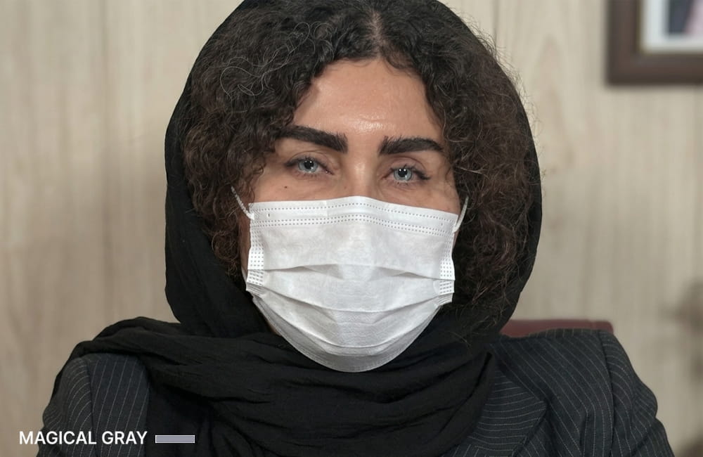 مريضة إيرانية بعيون رمادية سحرية بعد تغيير لون العيون الدائم بزراعة الصباغ القرنية في مركز عيون كروماتيك الطبي