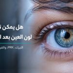 هل يمكن تغيير لون العين بعد الليزك أو PRK أو الفيمتو سمايل في مركز كروماتيك بإيران؟
