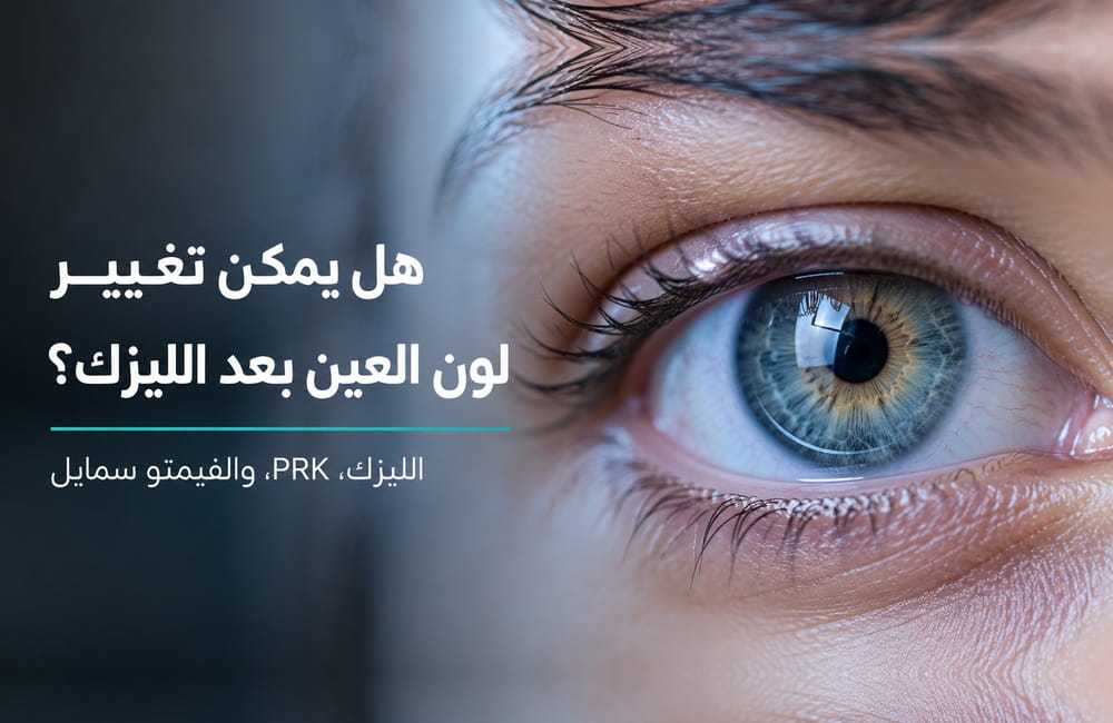 هل يمكن تغيير لون العين بعد الليزك (LASIK) أو تقنية PRK أو الفيمتو سمايل (SMILE)؟
