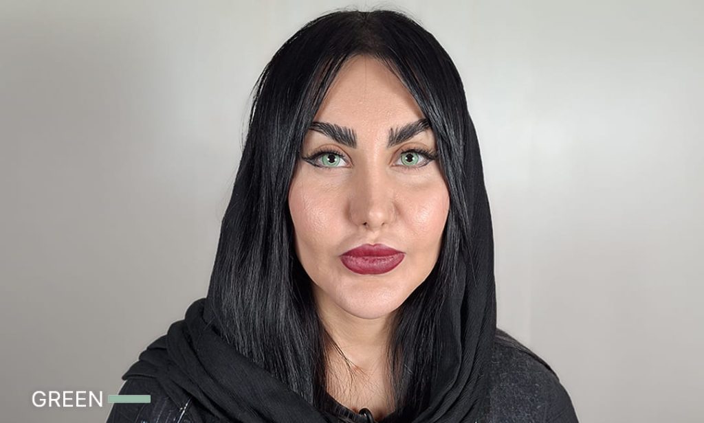نتيجة اللون الأخضر بعد الكيراتوبيغمنتيشن في Chromatic Eyes