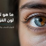ما هو تغاير لون القزحية (Heterochromia)؟ الأنواع والأسباب وتأثيره على النظر