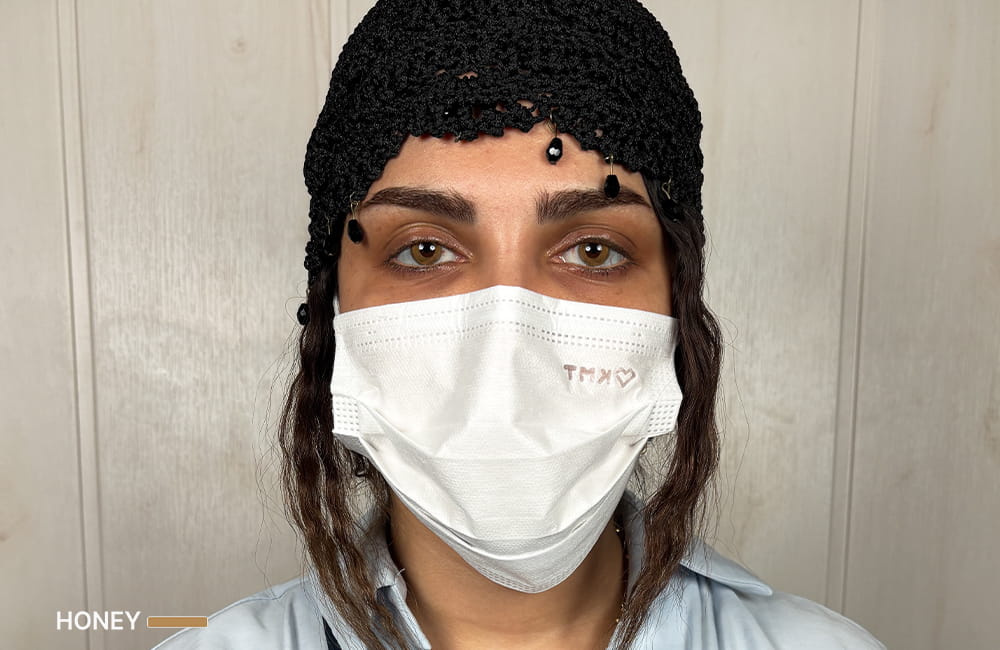 نتيجة اللون العسلي بعد الكيراتوبيغمنتيشن في Chromatic Eyes