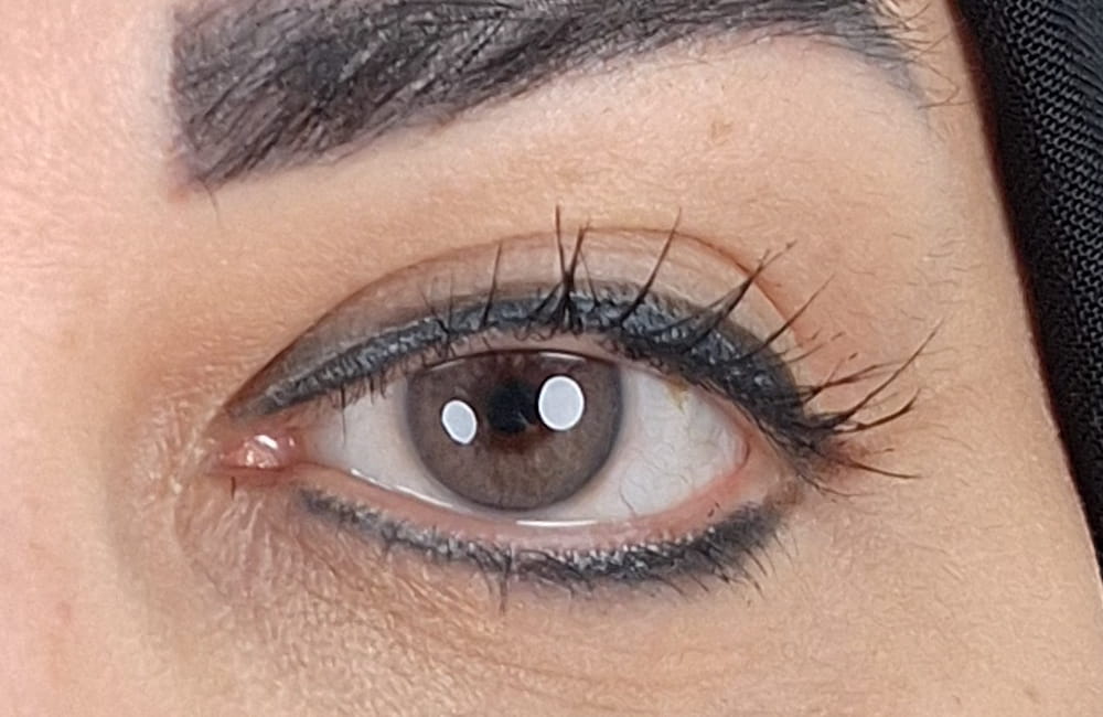 نتيجة اللون العسلي بعد جلستين تفتيح بالليزر في Chromatic Eyes