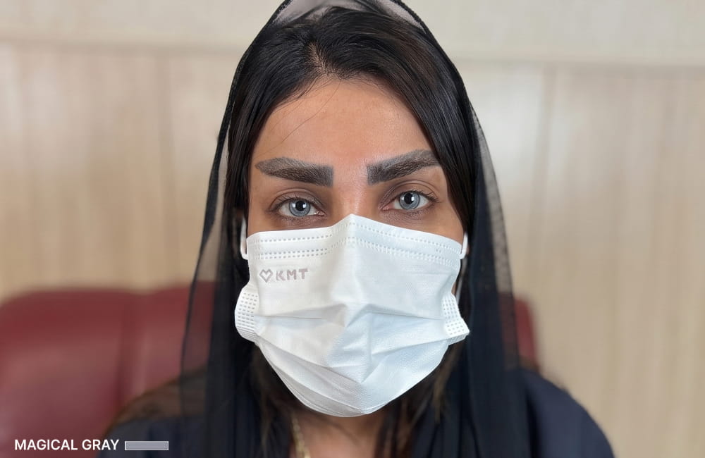 نتيجة اللون الرمادي الساحر بعد الكيراتوبيغمنتيشن في Chromatic Eyes