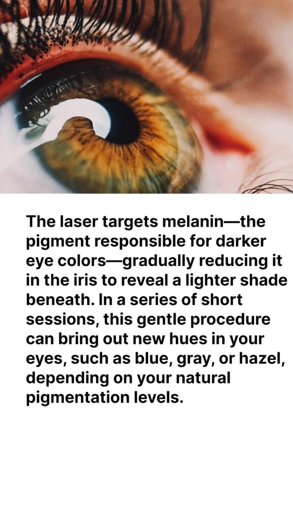 Why Consider Laser Eye Color Change?