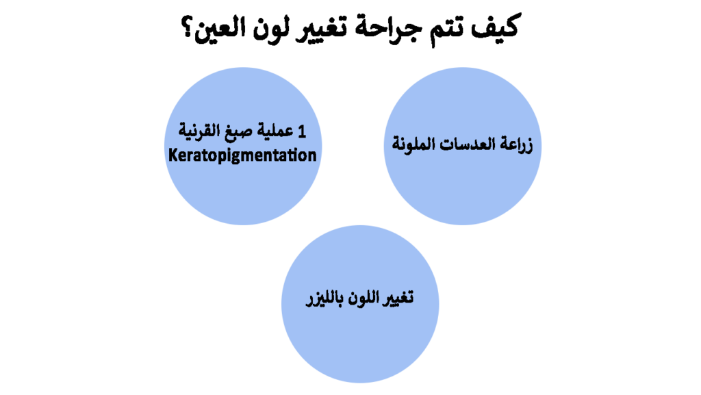 كيف تتم جراحة تغيير لون العين؟