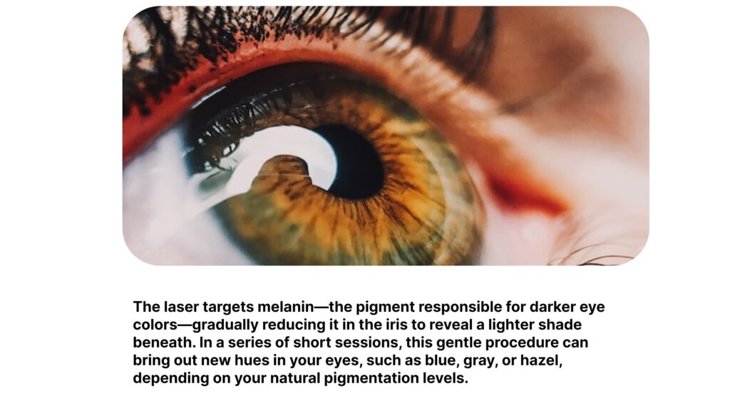 Why Consider Laser Eye Color Change?