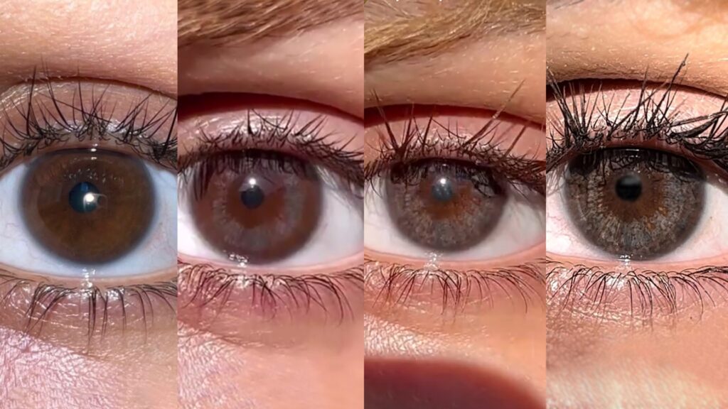 Results of eye color change with laser
