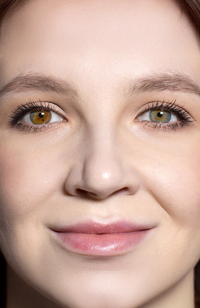 Heterochromia and eye color change