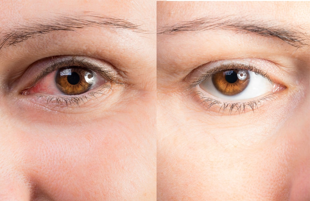 What chemicals are used in eye color changing drops?