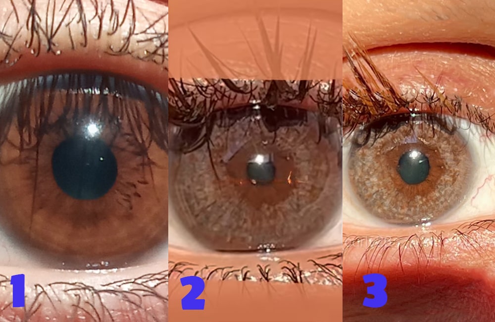 What to Expect During and After the Procedure?