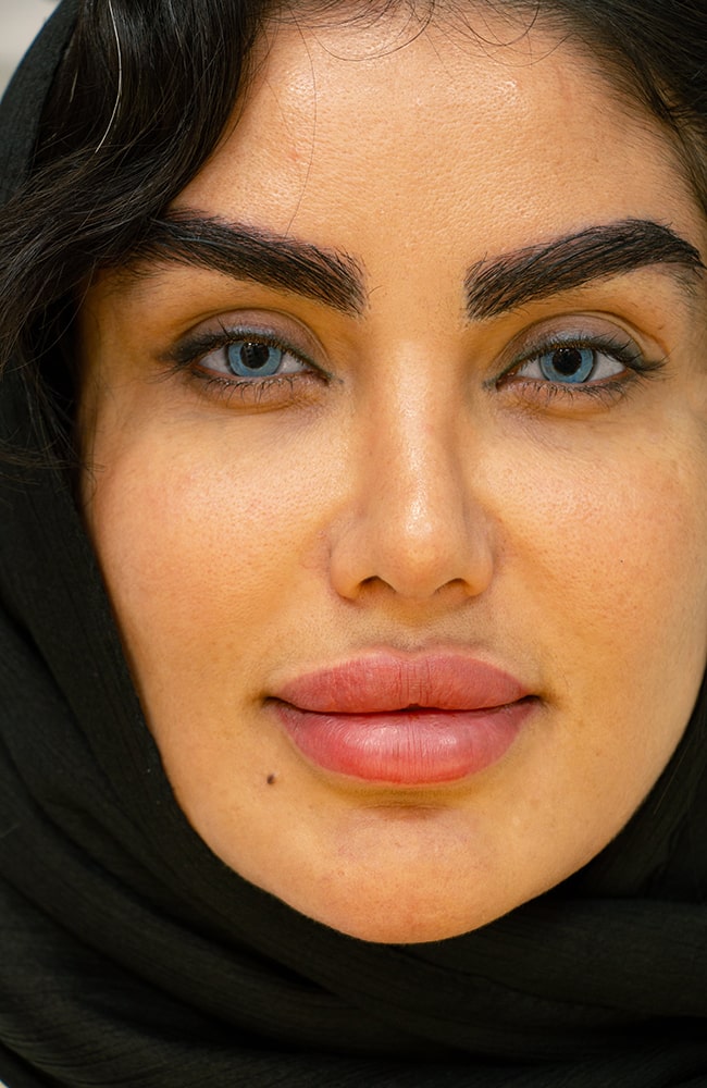 تغيير لون العين عبر صبغ القرنية