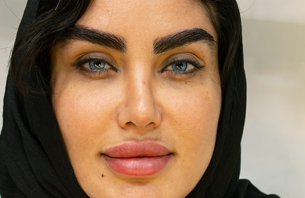 تغيير لون العين عبر صبغ القرنية