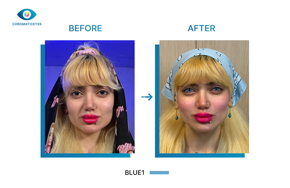 Before and after eye color change to Blue1 for blonde female with keratopigmentation - Chromatic Eyes