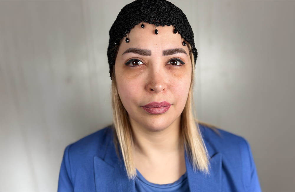 Iranian female patient with natural brown eyes before Olive Green eye color change by keratopigmentation at Chromatic Eyes