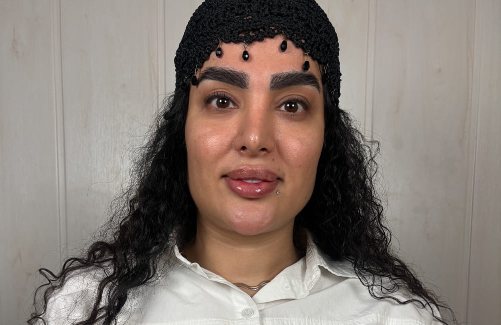 Iranian female patient with natural brown eyes before Magical Gray eye color change by keratopigmentation at Chromatic Eyes