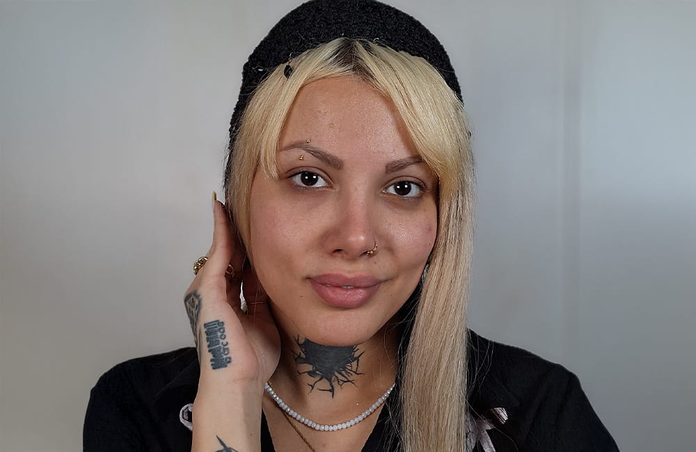 Female patient with natural dark brown eyes before French Blue eye color change by keratopigmentation at Chromatic Eyes