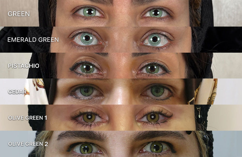 Green eye color shades after keratopigmentation surgery - Chromatic Eyes