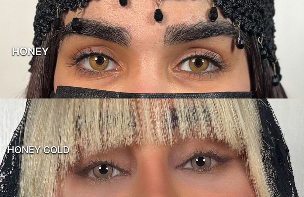 Honey and Honey Gold eye color shades after keratopigmentation surgery - Chromatic Eyes