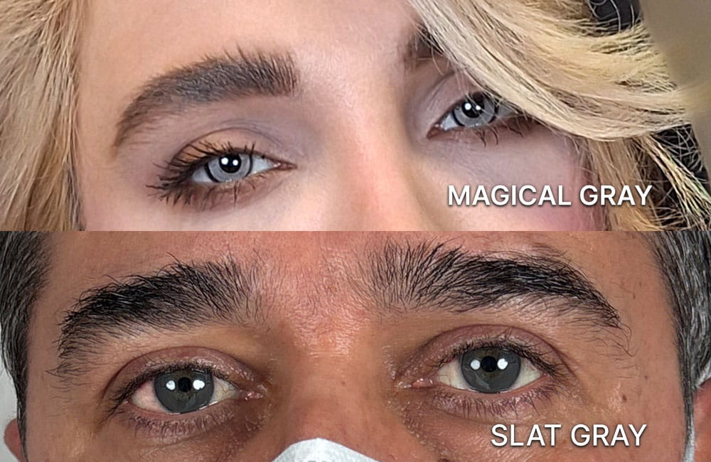 Magical Gray and Slate Gray eye color shades after keratopigmentation - Chromatic Eyes