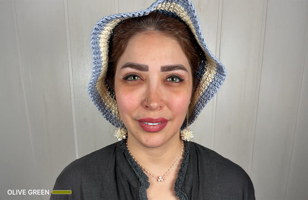Iranian female patient with Olive Green corneal pigmentation result after permanent eye color change by keratopigmentation at Chromatic Eyes
