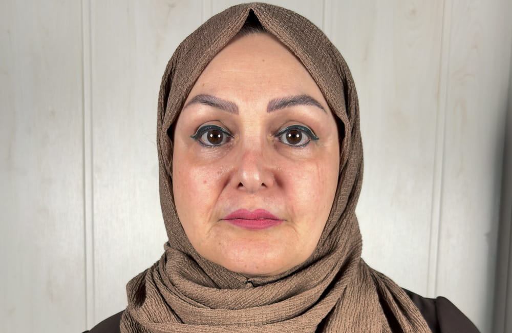 Female patient with natural brown eyes before permanent eye color change with keratopigmentation at Chromatic Eyes Medical Center