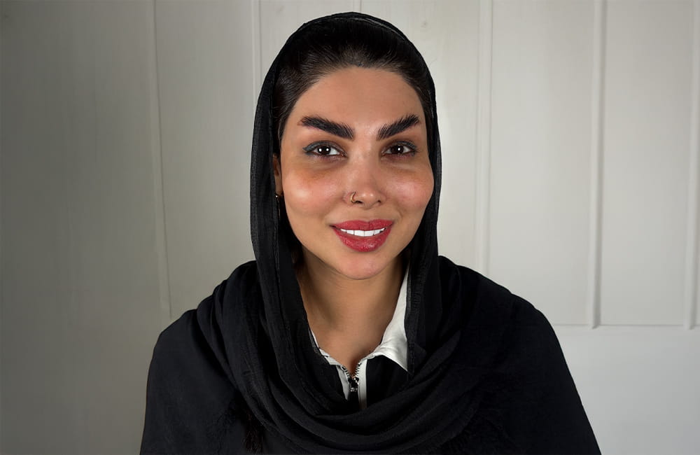 Iranian female patient with natural dark brown eyes before Magical Gray eye color change by keratopigmentation at Chromatic Eyes Medical Center, Vanak Square, Tehran, Iran