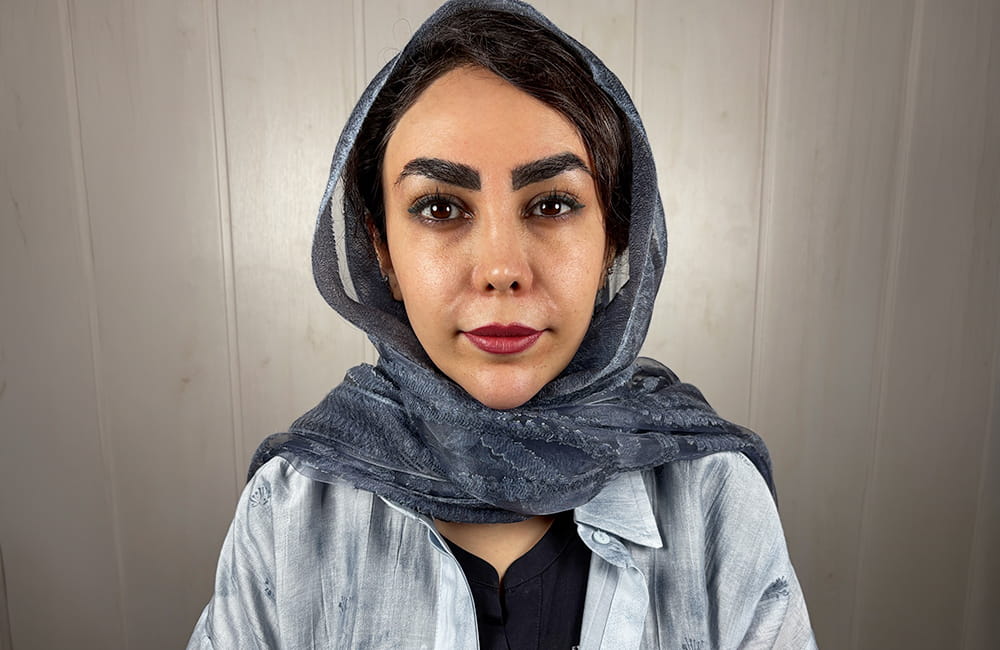 Female patient with natural dark brown eyes before Magical Gray eye color change by keratopigmentation at Chromatic Eyes Medical Center