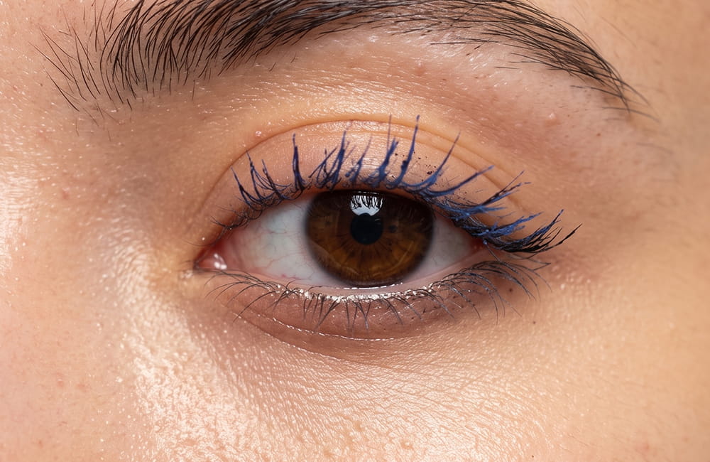 Iranian female patient with natural brown eyes before permanent laser eye color change at Chromatic Eyes Medical Center