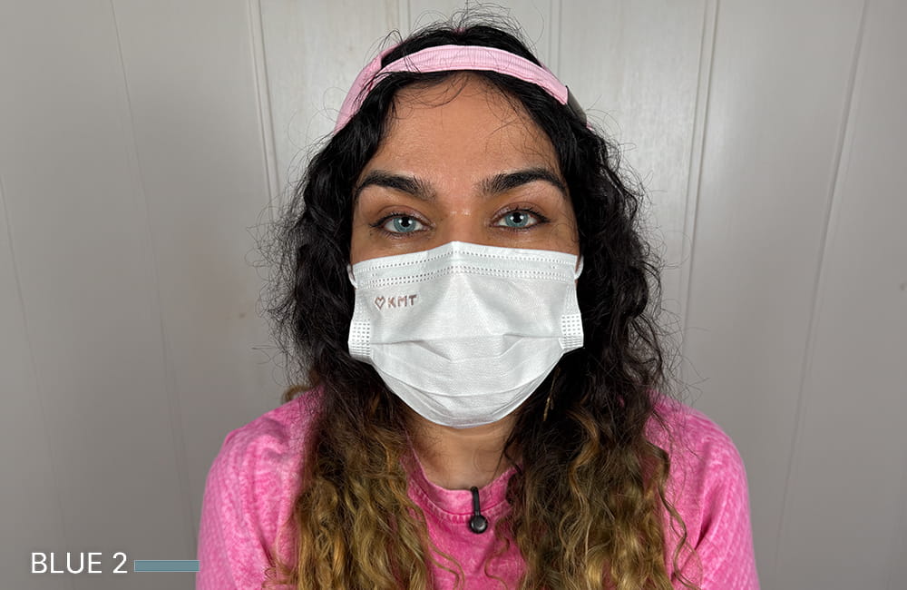 Iranian female patient with Blue corneal pigmentation result after permanent eye color change by keratopigmentation at Chromatic Eyes Medical Center, Vanak Square, Tehran, Iran