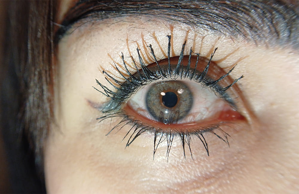 Female patient with hazel eyes after permanent laser eye color change at Chromatic Eyes Medical Center, Vanak Square, Tehran, Iran