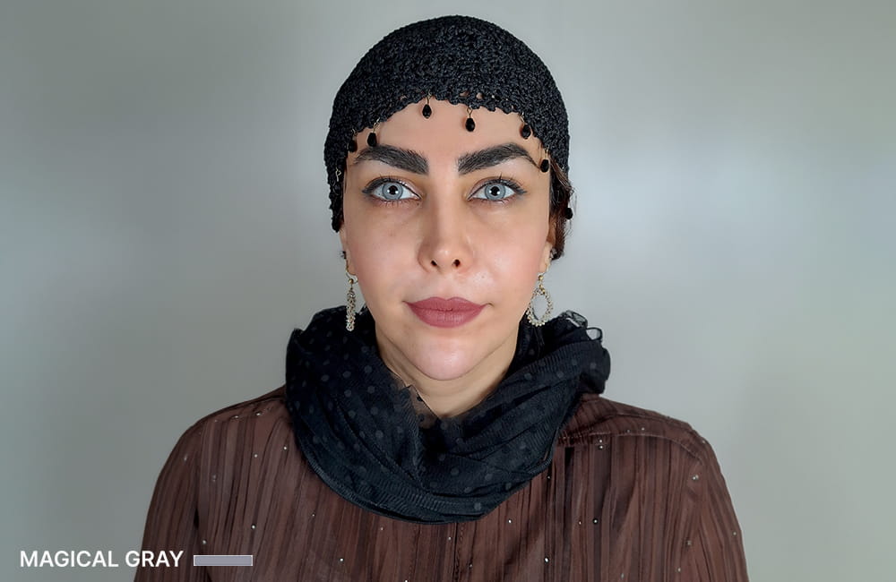 Female patient with Magical Gray corneal pigmentation result after permanent eye color change by keratopigmentation at Chromatic Eyes Medical Center
