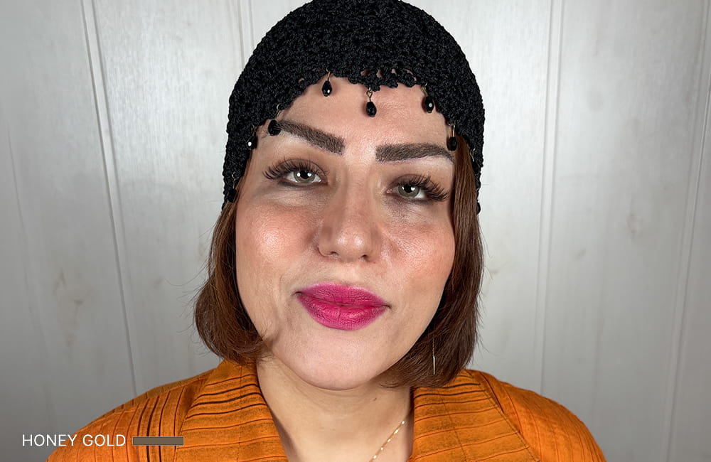 Female patient with Honey Gold corneal pigmentation result after permanent eye color change by keratopigmentation at Chromatic Eyes Medical Center
